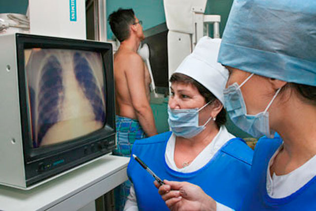 У Світловодську та Світловодському районі спостерігається ріст кількості хворих на туберкульоз