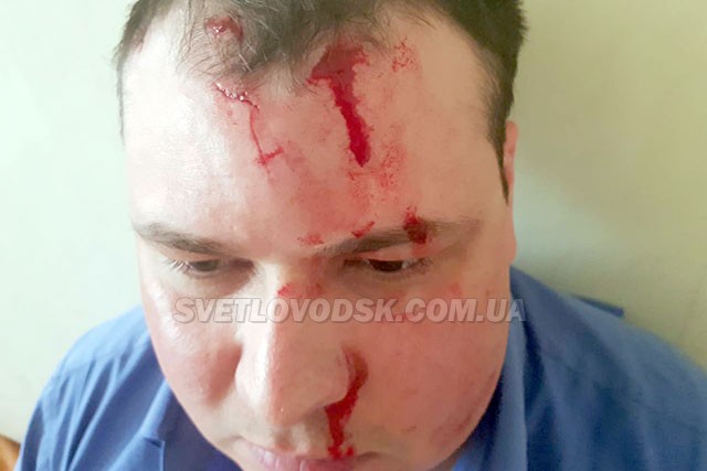 Члена виконавчого комітету Світловодської міської ради жорстоко побили у Кременчуці